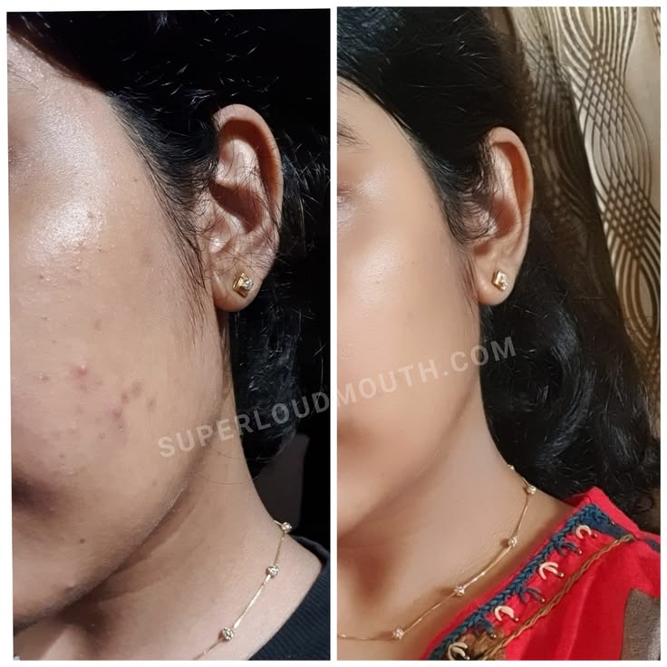 💖 প্রতিদিন শত শত মানুষের উপকার পাওয়ার রিভিউ